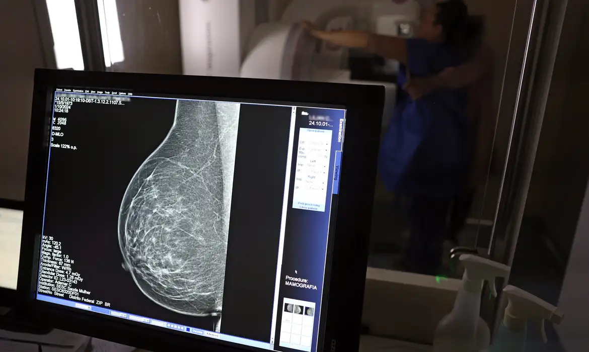 ANS derruba limite de idade para mamografia digital em planos de saúde